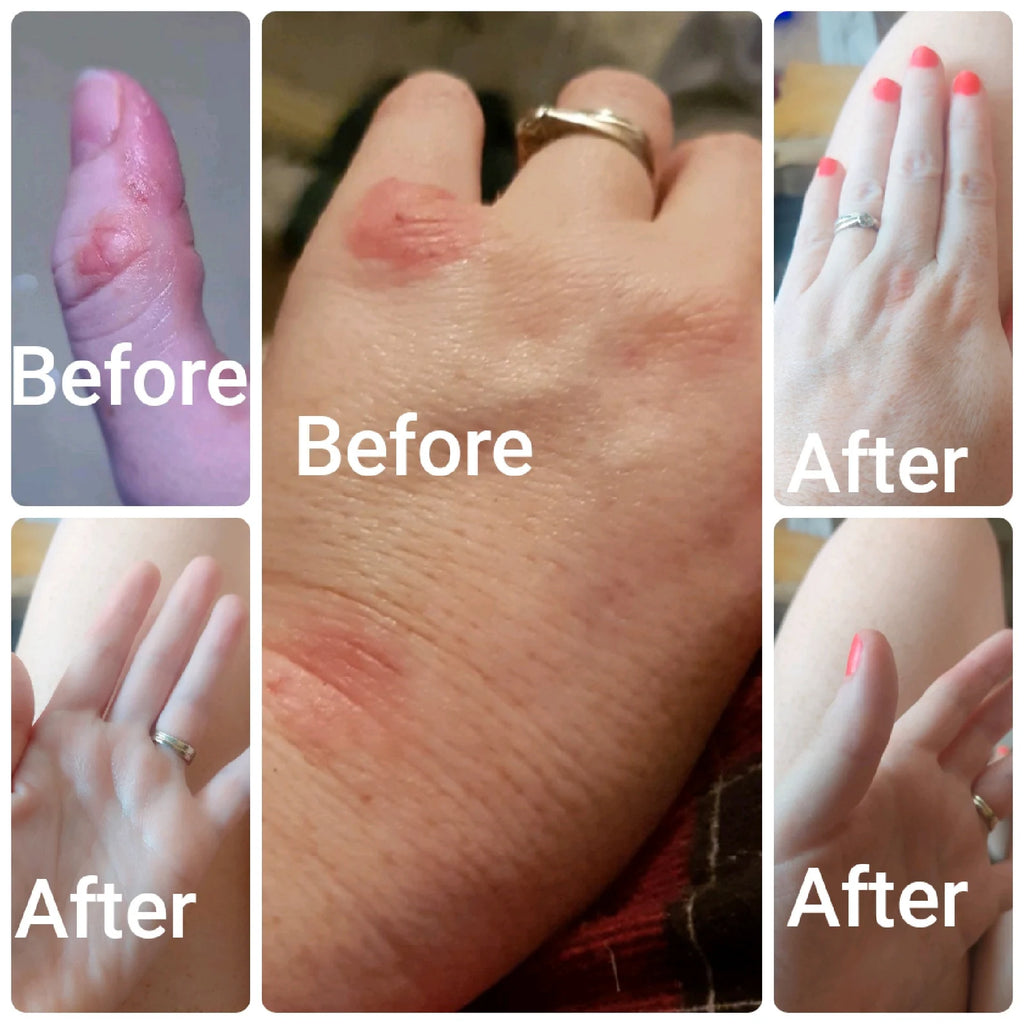 Local Beeswax Body Balm